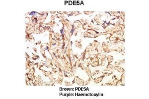 Sample Type: Human placental tissue  Primary Antibody Dilution: 1:100Secondary Antibody: Goat anti rabbit-HRP  Secondary Antibody Dilution: 1:00,000Color/Signal Descriptions: Brown: PDE5APurple: Haemotoxylin  Gene Name: PDE5A Submitted by: Dr. (PDE5A Antikörper  (C-Term))