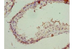Immunohistochemistry (IHC) image for anti-Proteasome (Prosome, Macropain) 26S Subunit, Non-ATPase, 1 (PSMD1) (AA 1-226), (Regulatory Subunit 10) antibody (ABIN7142198)