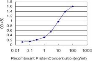 Detection limit for recombinant GST tagged CRX is approximately 0. (CRX Antikörper  (AA 1-95))