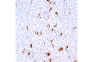 Immunohistochemistry (IHC) image for anti-CD68 Molecule (CD68) antibody (ABIN7449045) (Rekombinanter CD68 Antikörper)