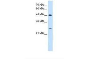 Image no. 1 for anti-SH3 Domain Binding Glutamic Acid-Rich Protein (SH3BGR) (AA 139-188) antibody (ABIN6738186)