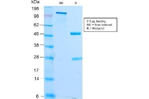 SDS-PAGE Analysis Purified MITF Recombinant Rabbit Monoclonal Antibody (MITF/2987R). (Rekombinanter MITF Antikörper)