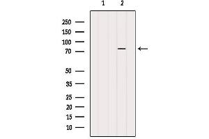 PARP2 Antikörper  (Internal Region)