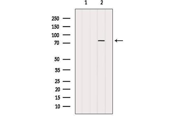 PARP2 Antikörper  (Internal Region)