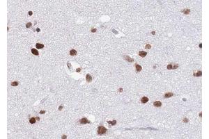 ABIN6268809 at 1/100 staining human brain tissue sections by IHC-P.