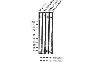 Western blot analysis of Phospho-C/EBP beta (Thr235/188) expression in various lysates (CEBPB Antikörper  (pThr235))