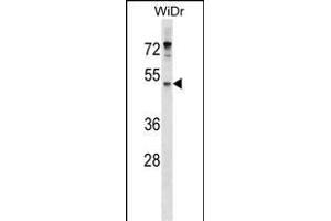 EN Antibody (Center) (ABIN1537947 and ABIN2849680) western blot analysis in WiDr cell line lysates (35 μg/lane). (ENPP4 Antikörper  (AA 171-200))