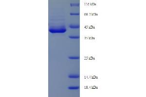 SDS-PAGE (SDS) image for Apoptosis Enhancing Nuclease (AEN) (AA 117-325), (partial) protein (His-SUMO Tag) (ABIN5711525)