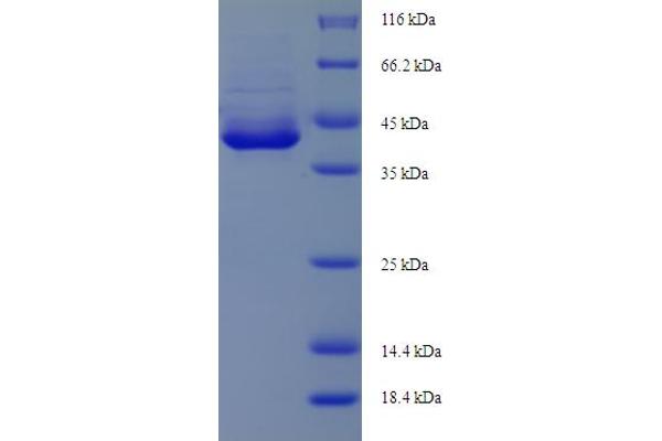 AEN Protein (AA 117-325, partial) (His-SUMO Tag)