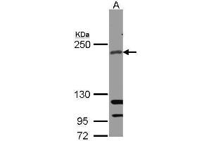 WB Image Sample(30 ug whole cell lysate) A: A431 , 5% SDS PAGE antibody diluted at 1:1000