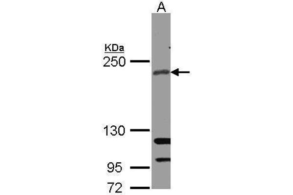 RICTOR anticorps  (C-Term)