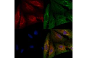 ABIN6263511 and ABIN6276331 staining  cells by IF/ICC. (NAMPT Antikörper  (C-Term))