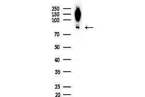 anti-Phosphatidylinositol Glycan Anchor Biosynthesis, Class Q (PIGQ) (Internal Region) antibody