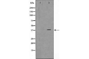 Western blot analysis on K562 cell lysate using ARMX3 Antibody,The lane on the left is treated with the antigen-specific peptide.