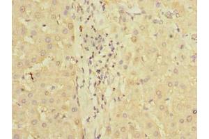Immunohistochemistry of paraffin-embedded human liver tissue using ABIN7163092 at dilution of 1:100 (PDCL2 Antikörper  (AA 1-241))