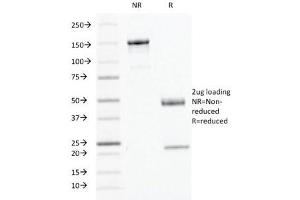 SDS-PAGE Analysis of Purified, BSA-Free IFN gamma Antibody (clone IFNG/466).