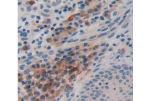 IHC-P analysis of Human Tissue, with DAB staining. (FBLN4 Antikörper  (AA 278-366))