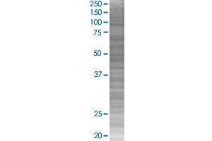 PLA2G4B transfected lysate. (PLA2G4B 293T Cell Transient Overexpression Lysate(Denatured))