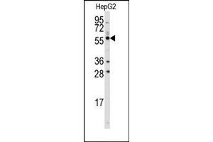 Image no. 1 for anti-Aldehyde Dehydrogenase 3 Family, Member B1 (ALDH3B1) (C-Term) antibody (ABIN360239) (ALDH3B1 Antikörper  (C-Term))