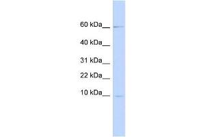 Image no. 1 for anti-Peptidase Inhibitor 3, Skin-Derived (PI3) antibody (ABIN635954) (PI3 Antikörper)