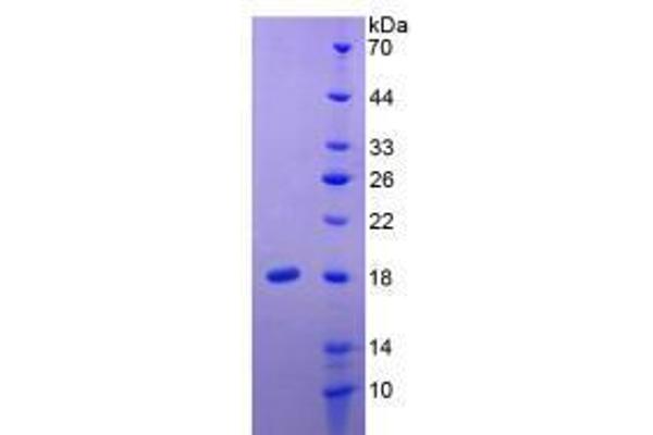 IL-24 Protein (AA 51-206) (His tag)