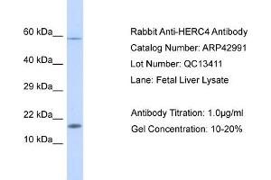 WB Suggested Anti-HERC4 Antibody   Titration: 1. (HERC4 Antikörper  (Middle Region))