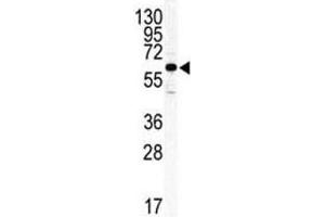 Western blot analysis of ILK2/ILK1 antibody and HeLa lysate. (ILK Antikörper  (AA 391-421))