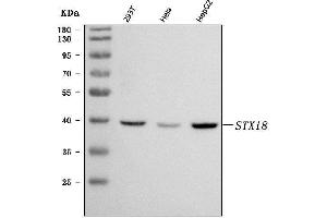 Western blot analysis of Syntaxin 18/STX18 using anti-Syntaxin 18/STX18 antibody (ABIN7599259). (Syntaxin 18 Antikörper  (AA 1-313))