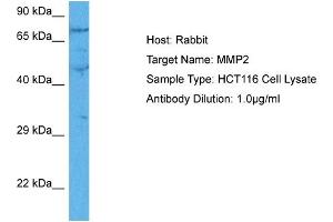 Host:  Rabbit  Target Name:  MMP2  Sample Tissue:  Human HCT116 Whole Cell  Antibody Dilution:  1ug/ml (MMP2 Antikörper  (C-Term))