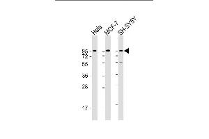 All lanes : Anti-DAG1 Antibody (C-term) at 1:2000 dilution Lane 1: Hela whole cell lysate Lane 2: MCF-7 whole cell lysate Lane 3: SH-SY5Y whole cell lysate Lysates/proteins at 20 μg per lane. (Dystroglycan Antikörper  (C-Term))