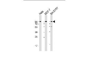 Dystroglycan Antikörper  (C-Term)