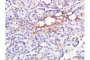 Formalin-fixed and paraffin embedded rat pancreas labeled with Anti-RAP1GAP Polyclonal Antibody, Unconjugated (ABIN681673) at 1:200 followed by conjugation to the secondary antibody and DAB staining