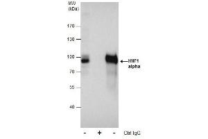 Immunoprecipitation (IP) image for anti-HNF1 Homeobox A (HNF1A) antibody (ABIN2856932)