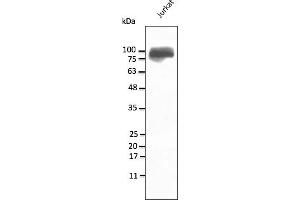 Western Blotting (WB) image for anti-Integrin beta 2 (ITGB2) (N-Term) antibody (ABIN7273029) (Integrin beta 2 Antikörper  (N-Term))