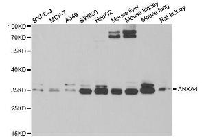 Western blot analysis of extracts of various cell lines, using ANXA4 antibody. (Annexin IV Antikörper  (AA 112-321))