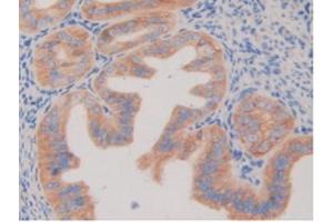 IHC-P analysis of Mouse Ovary Tissue, with DAB staining. (PDGFRB Antikörper  (AA 337-583))
