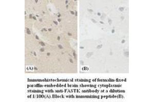 Image no. 1 for anti-Fas-Activated serine/threonine Kinase (FASTK) antibody (ABIN791134) (FASTK Antikörper)