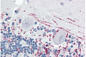 Human Brain, Cerebellum (formalin-fixed, paraffin-embedded) stained with MBP antibody ABIN364503 at 1:100 followed by biotinylated goat anti-rabbit IgG secondary antibody ABIN481713, alkaline phosphatase-streptavidin and chromogen. (MBP Antikörper)