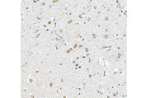 IHC analysis of RPL29 using anti-RPL29 antibody (ABIN7600993). (RPL29 Antikörper  (AA 27-153))