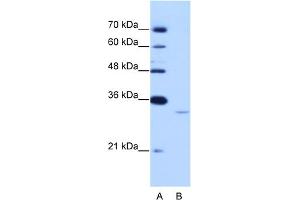 WB Suggested Anti-EXOSC6 Antibody Titration:  0.