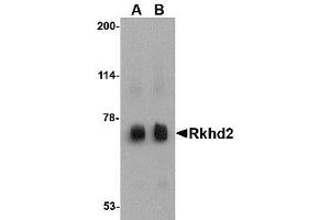 Image no. 1 for anti-Mex-3 Homolog C (C. Elegans) (MEX3C) (C-Term) antibody (ABIN341683) (MEX3C Antikörper  (C-Term))