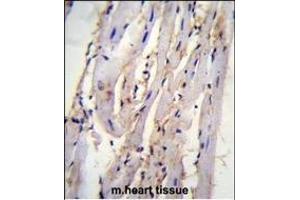 STX19 Antibody (C-term) (ABIN655437 and ABIN2844972) immunohistochemistry analysis in formalin fixed and paraffin embedded m. (Syntaxin 19 Antikörper  (C-Term))