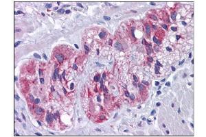 Human Colon, Myenteric Plexus: Formalin-Fixed, Paraffin-Embedded (FFPE) (SLC39A7 Antikörper  (N-Term))