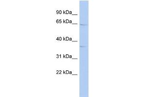 WB Suggested Anti-KIAA1191 Antibody Titration: 0. (KIAA1191 Antikörper  (Middle Region))