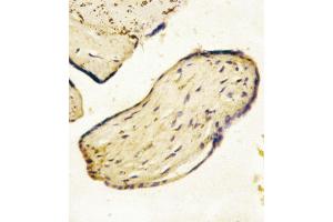Formalin-fixed and paraffin-embedded human Placenta tissue reacted with CD73 (NT5E) Antibody (C-term), which was peroxidase-conjugated to the secondary antibody, followed by AEC staining. (CD73 Antikörper  (C-Term))