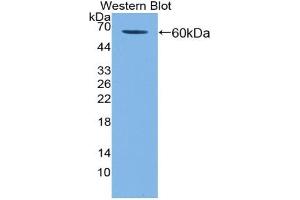 Western blot analysis of the recombinant protein. (KIR2DL3 Antikörper  (AA 22-342))
