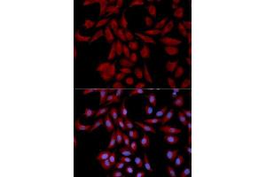 Immunofluorescence analysis of U2OS cells using UBE2I antibody. (UBE2I Antikörper  (AA 1-158))