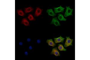 ABIN7094337 and ABIN7098384 staining HepG2 cells by IF/ICC. (LC3C Antikörper  (C-Term))