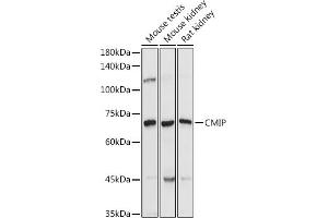 Western blot analysis of extracts of various cell lines, using CMIP antibody (ABIN7265970) at 1:1000 dilution.