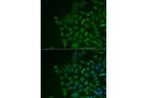 Immunofluorescence analysis of MCF7 cells using LRAT antibody (ABIN6132018, ABIN6143312, ABIN6143315 and ABIN6217189).